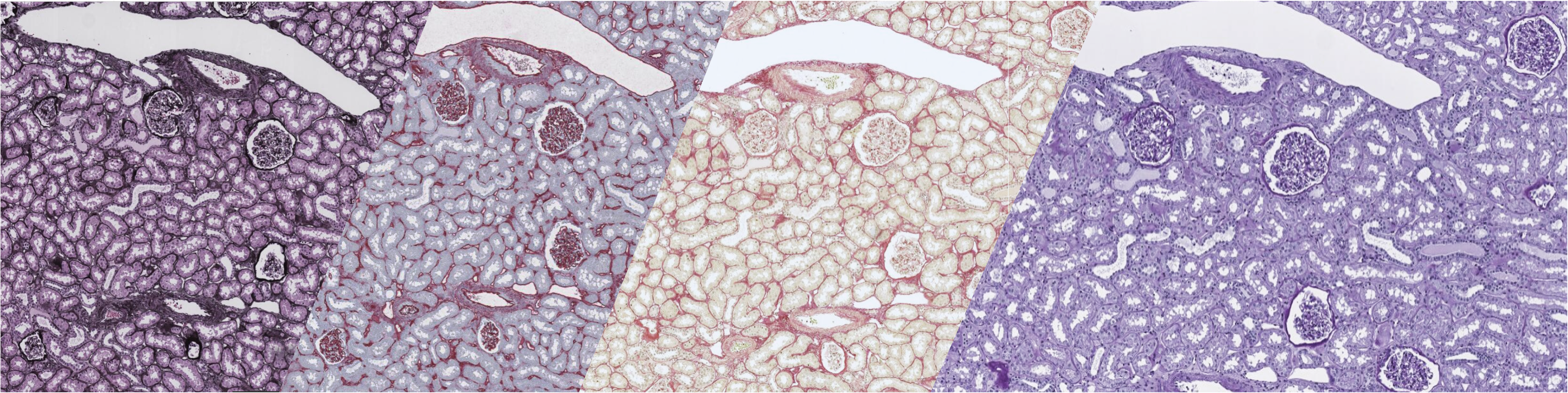 Histopathology Image